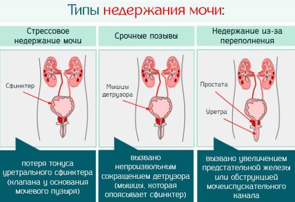 Берут ли в армию с больной спиной? Топ-7 болезней спины