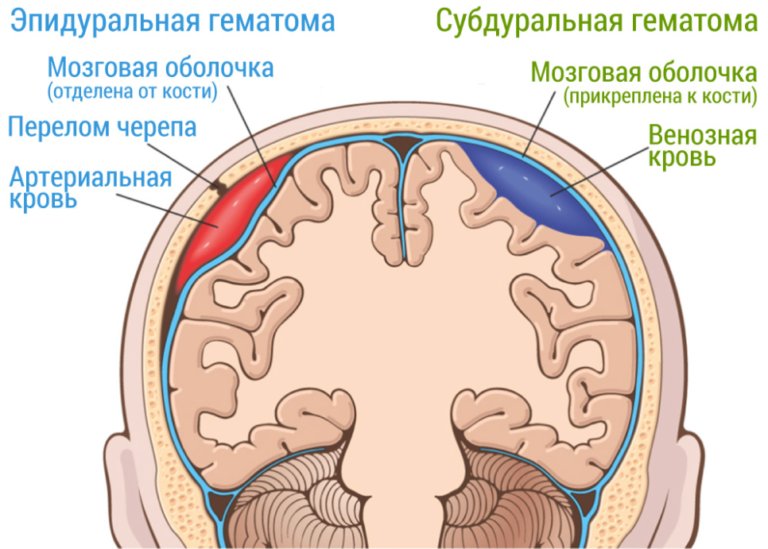 Сотрясение головы фото